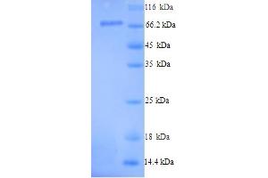 SDS-PAGE (SDS) image for Peptidyl Arginine Deiminase, Type I (PADI1) (AA 1-663), (full length) protein (His tag) (ABIN5714510) (PADI1 Protein (AA 1-663, full length) (His tag))