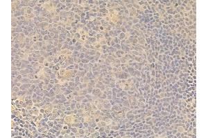 SGK1 Antibody at 1/100 staining human normal tonsil tissue by IHC-P.