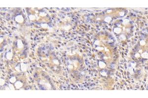 Detection of BMP2 in Human Small intestine Tissue using Polyclonal Antibody to Bone Morphogenetic Protein 2 (BMP2) (BMP2 antibody  (AA 24-396))
