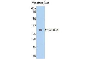 Western Blotting (WB) image for anti-C-Reactive Protein (CRP) (AA 20-225) antibody (ABIN1077877)