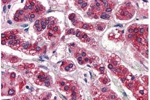 Human Adrenal: Formalin-Fixed, Paraffin-Embedded (FFPE) (APOE antibody)