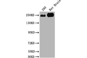 Western Blot Positive WB detected in: 293 whole cell lysate, Rat Brain tissue All lanes: MYH10 antibody at 1:2000 Secondary Goat polyclonal to rabbit IgG at 1/50000 dilution Predicted band size: 229, 231, 232, 233 kDa Observed band size: 250 kDa (MYH1 antibody  (AA 1439-1544))