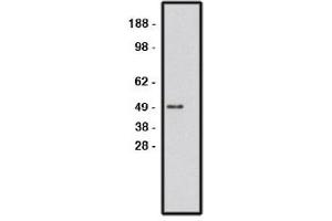 Image no. 1 for anti-Roundabout, Axon Guidance Receptor, Homolog 1 (ROBO1) antibody (ABIN265227) (ROBO1 antibody)