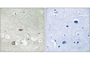 Immunohistochemistry analysis of paraffin-embedded human brain tissue, using CELSR2 Antibody. (CELSR2 antibody  (AA 2781-2830))