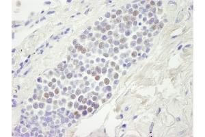 Immunohistochemistry (IHC) image for anti-Minichromosome Maintenance Deficient 4 (MCM4) (AA 325-375) antibody (ABIN7448653) (MCM4 antibody  (AA 325-375))