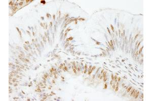 Immunohistochemistry (IHC) image for anti-Ubiquitin Specific Peptidase 47 (USP47) (C-Term) antibody (ABIN7454387)