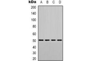 Western blot analysis of LXR alpha expression in SHSY5Y (A), HEK293T (B), NIH3T3 (C), rat muscle (D) whole cell lysates. (NR1H3 antibody)