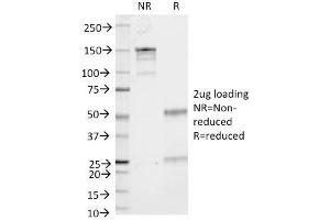 SDS-PAGE Analysis Purified CD53 Mouse Monoclonal Antibody (161-2).