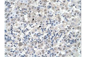 Immunohistochemistry (IHC) image for anti-Cerebellar Degeneration-Related Protein 2, 62kDa (CDR2) (N-Term) antibody (ABIN2773981) (CDR2 antibody  (N-Term))