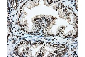 Immunohistochemical staining of paraffin-embedded lung tissue using anti-ARNTL mouse monoclonal antibody. (ARNTL antibody)