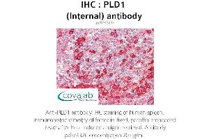 Image no. 1 for anti-Phospholipase D1 (PLD1) (Internal Region) antibody (ABIN1738146) (PLD1 antibody  (Internal Region))