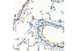 Immunohistochemistry of paraffin-embedded rat lung using RGS5 antibody (ABIN5975077) at dilution of 1/100 (40x lens). (RGS5 antibody)