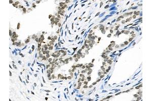 Phospho-MSH2 (Tyr238) Antibody at 1/100 staining Rat ovarian tissue by IHC-P.
