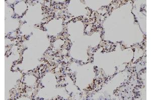ABIN6276948 at 1/100 staining Rat lung tissue by IHC-P. (PAD4 antibody  (N-Term))
