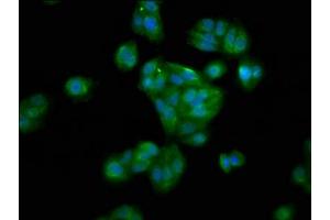Immunofluorescence staining of HepG2 cells with ABIN7155981 at 1:100, counter-stained with DAPI. (HAO1 antibody  (AA 161-273))