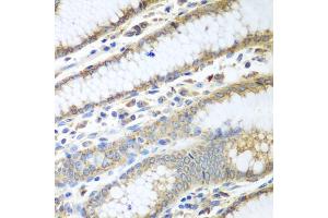 Immunohistochemistry of paraffin-embedded human stomach using PDIA3 antibody (ABIN5970443) at dilution of 1/100 (40x lens). (PDIA3 antibody)
