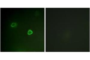 Immunofluorescence analysis of COS7 cells, using p90 RSK (Phospho-Thr573) Antibody. (RPS6KA3 antibody  (pThr573))