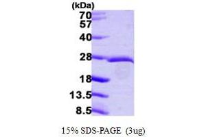 SDS-PAGE (SDS) image for Eukaryotic Translation Initiation Factor 3 Subunit K (EIF3K) (AA 1-218) protein (His tag) (ABIN667392)