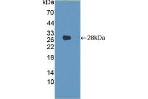 Detection of Recombinant LMNB1, Human using Polyclonal Antibody to Lamin B1 (LMNB1) (Lamin B1 antibody  (AA 52-233))