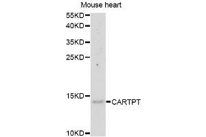 Western blot analysis of extracts of mouse heart, using CARTPT antibody (ABIN5975373) at 1/1000 dilution. (CARTPT antibody)