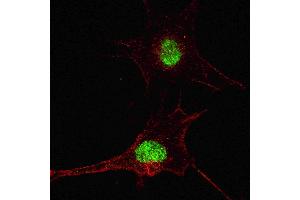Fluorescent confocal image of SY5Y cells stained with SOX2  antibody. (SOX2 antibody  (AA 251-284))