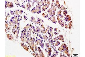 Formalin-fixed and paraffin embedded rat pancreas labeled with Anti-TRADD Polyclonal Antibody, Unconjugated (ABIN673314) at 1:200 followed by conjugation to the secondary antibody and DAB staining. (TRADD antibody  (AA 111-230))