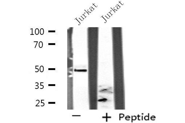 Septin 6 antibody  (Internal Region)