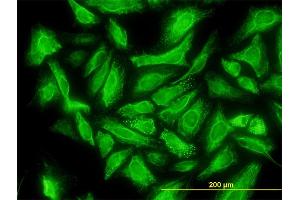 Immunofluorescence of monoclonal antibody to DCUN1D1 on HeLa cell. (DCUN1D1 antibody  (AA 1-89))