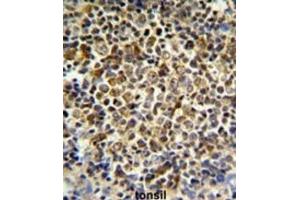 Immunohistochemistry (IHC) image for anti-Killer Cell Immunoglobulin-Like Receptor, Two Domains, Long Cytoplasmic Tail, 5B (KIR2DL5B) antibody (ABIN3003959)