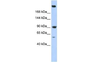 WB Suggested Anti-SPTAN1 Antibody Titration: 0. (SPTAN1 antibody  (N-Term))