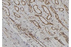 ABIN6276872 at 1/100 staining Human kidney tissue by IHC-P. (BUB1B antibody  (C-Term))