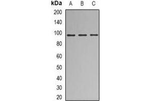 Western blot analysis of Nibrin expression in HEK293T (A), A549 (B), Jurkat (C) whole cell lysates. (Nibrin antibody)