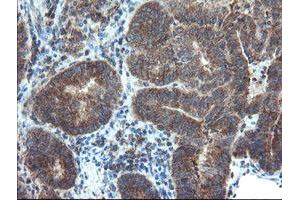 Image no. 1 for anti-Dual Specificity Phosphatase and Pro Isomerase Domain Containing 1 (DUPD1) antibody (ABIN1497927) (DUPD1 antibody)