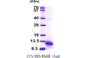 SDS-PAGE (SDS) image for Chemokine (C-C Motif) Ligand 18 (Pulmonary and Activation-Regulated) (CCL18) (AA 22-89) protein (His tag) (ABIN666793)