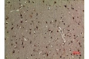 Immunohistochemistry (IHC) image for anti-Nuclear Factor-kB p65 (NFkBP65) (acLys314), (acLys315) antibody (ABIN3188030)