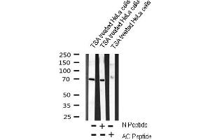 Western blot analysis on TSA treated HeLa cells lysate using AC-FKHR(K294) Antibody (AC-FKHR antibody)