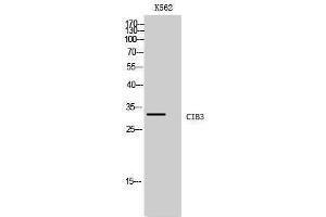 Western Blotting (WB) image for anti-Calcium and Integrin Binding Protein 3 (CIB3) (C-Term) antibody (ABIN3183921) (CIB3 antibody  (C-Term))