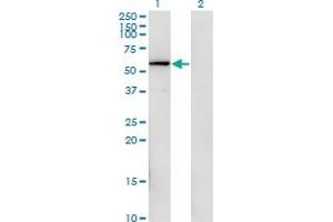 Western Blot analysis of FGFR1OP expression in transfected 293T cell line by FGFR1OP monoclonal antibody (M02), clone 1E8. (FGFR1OP antibody  (AA 1-379))