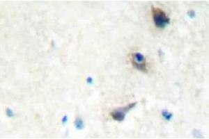 Immunohistochemistry (IHC) analyzes of IMK-1 antibody in paraffin-embedded human brain tissue. (LIM Domain Kinase 1 antibody)