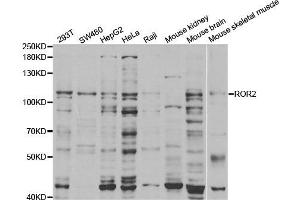 Western Blotting (WB) image for anti-Receptor Tyrosine Kinase-Like Orphan Receptor 2 (ROR2) antibody (ABIN1876821)