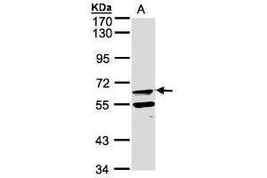 WB Image Sample(30 μg of whole cell lysate) A:Raji, 7. (FPGT antibody)