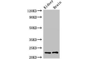 Western Blot Positive WB detected in: Rat kidney tissue, Mouse brain tissue All lanes: CHP1 antibody at 2.