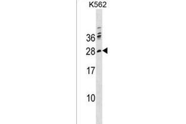 PTCRA antibody  (C-Term)