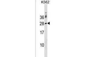 PTCRA Antibody (C-term) (ABIN1536828 and ABIN2850366) western blot analysis in K562 cell line lysates (35 μg/lane).