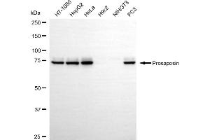 Western blotting analysis using prosaposin antibody (ABIN7799930). (Recombinant Prosaposin antibody)