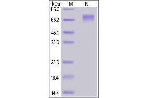 Biotinylated Human GUCY2C, His,Avitag on  under reducing (R) condition. (GUCY2C Protein (AA 24-430) (His tag,AVI tag,Biotin))