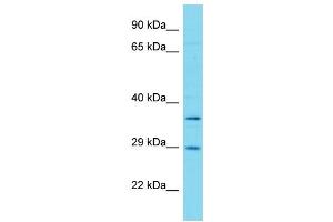 Host: Rabbit Target Name: FAHD1 Sample Type: Hela Whole cell lysates Antibody Dilution: 1.