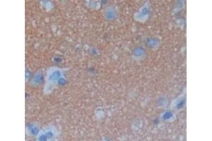 Used in DAB staining on fromalin fixed paraffin- embedded Kidney tissue (C6orf150 antibody  (AA 225-407))