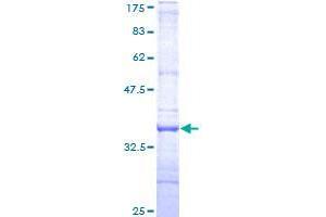 RNF167 Protein (AA 78-172) (GST tag)