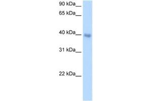 Western Blotting (WB) image for anti-Distal-Less Homeobox 5 (DLX5) antibody (ABIN2460595) (DLX5 antibody)